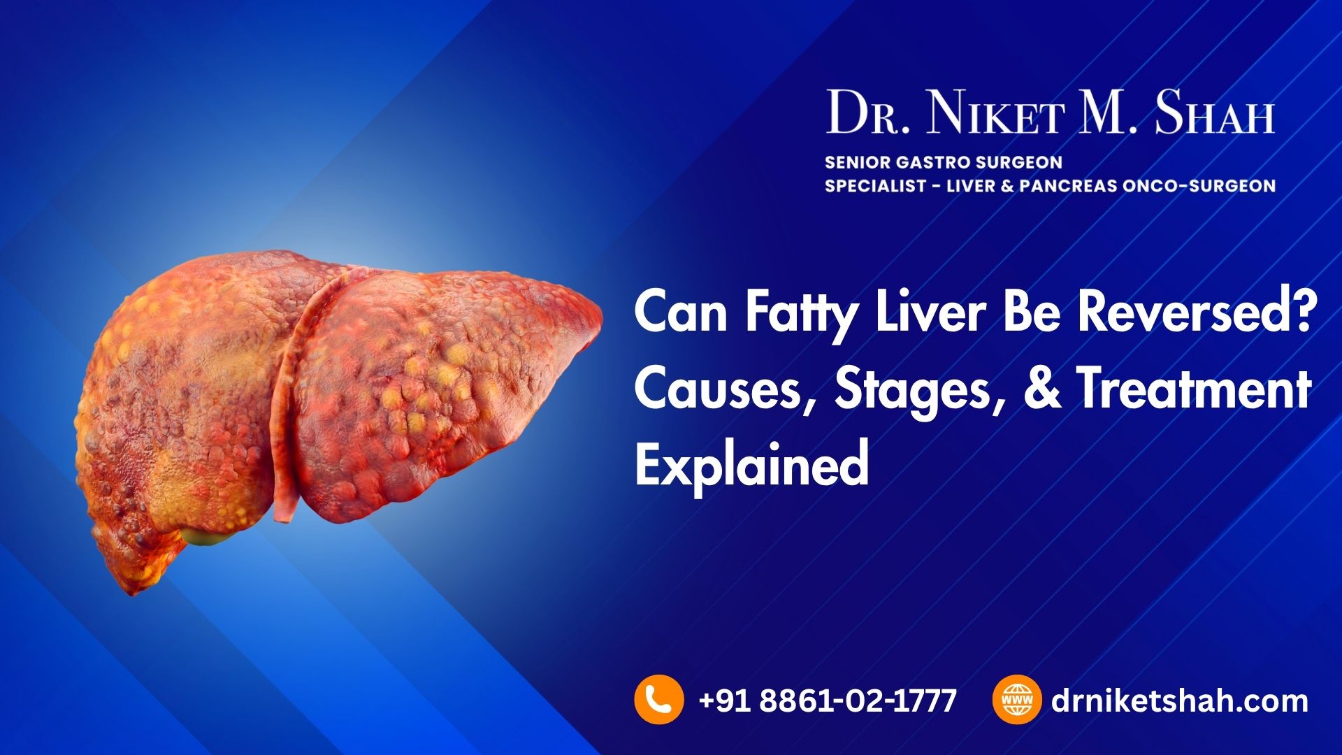 Can Fatty Liver Be Reversed? Causes, Stages, and Treatment Explained